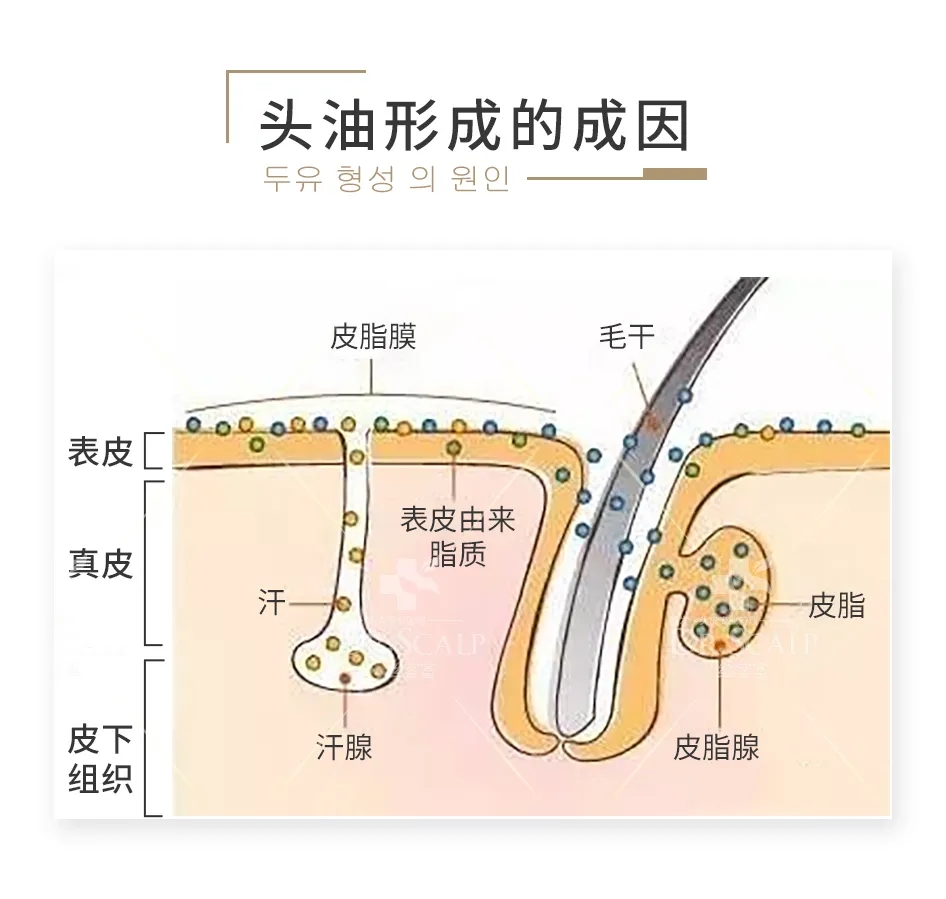 头发头皮油腻