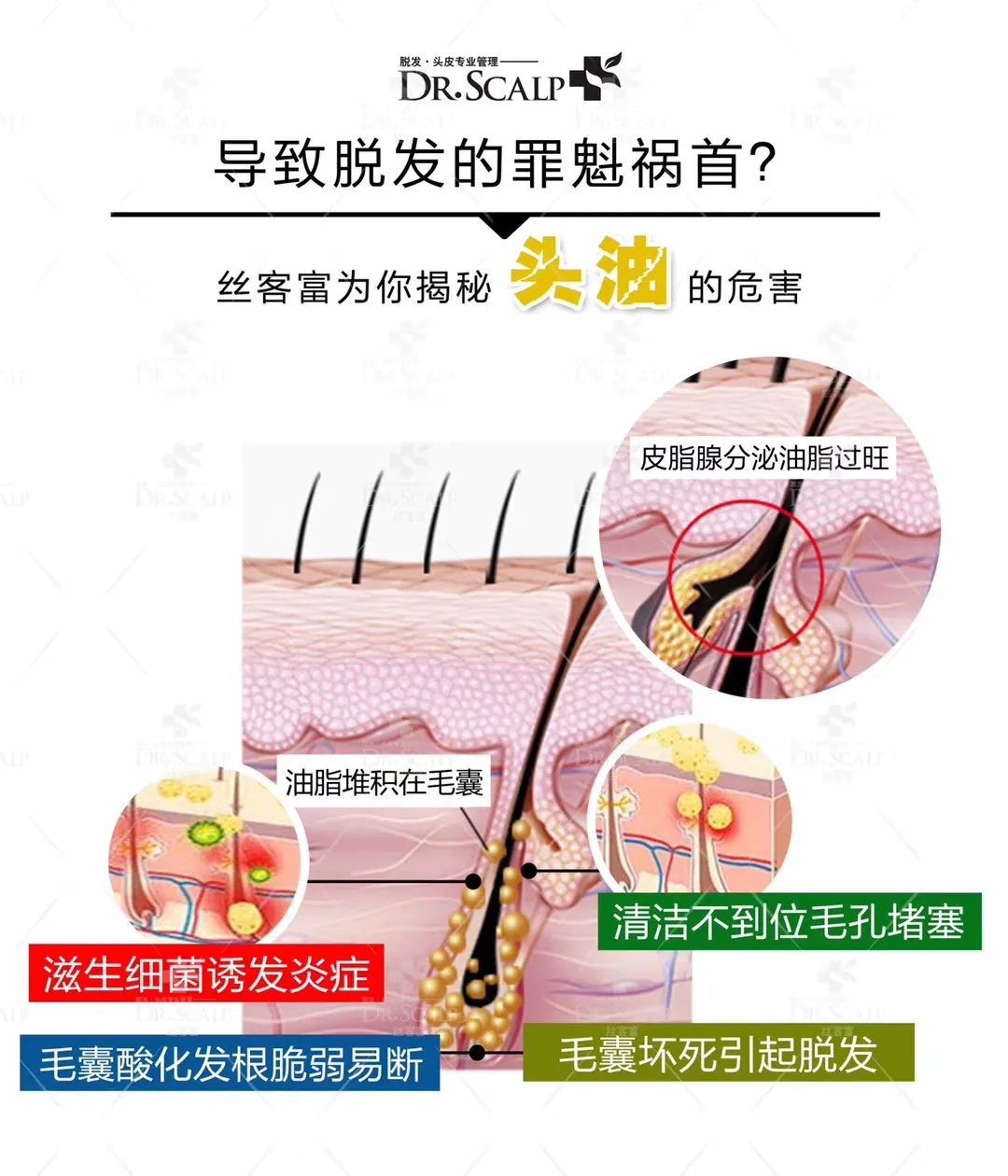 头发头皮油腻脱发